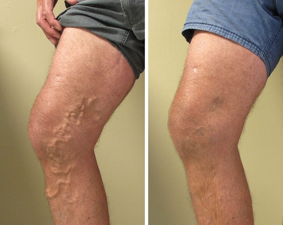 Experience using gel zxcvbnmqwt