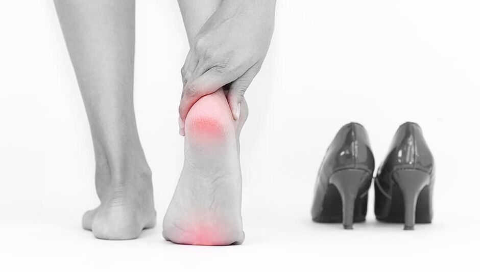 The reason for the appearance of varicose veins is a disturbing shoe