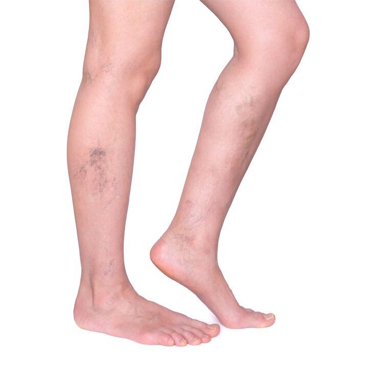 Tips for Zxcvbnmqgtin Astay - Nabushhiy, convincing veins on their feet