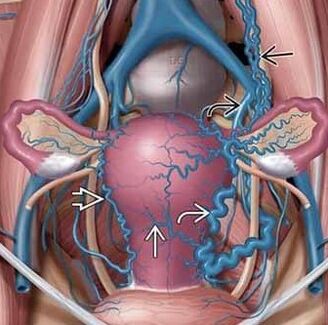 To change the structure of the vein walls